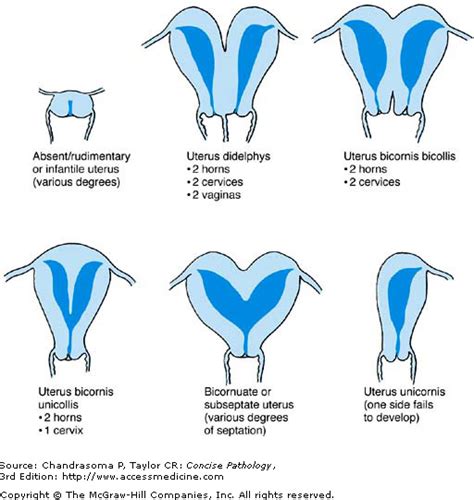 innie vs outie vsgina|6 Different Types Of Labia—Illustrated